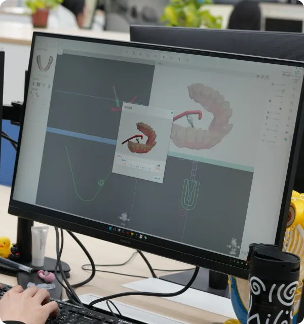 Computer screen showing a 3D dental model with hands working on a keyboard at a desk.