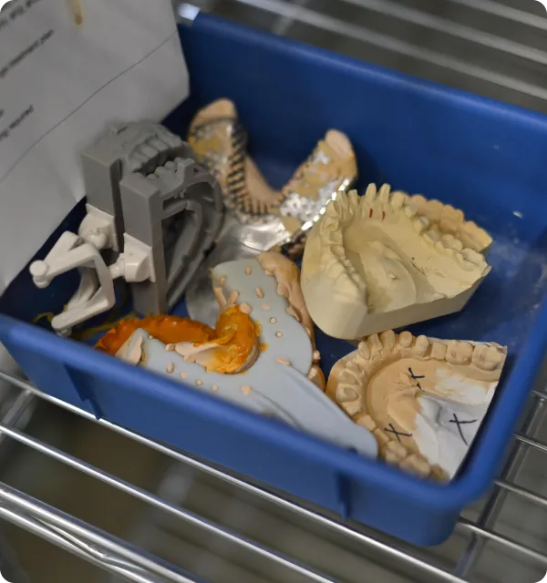 Blue tray holding several dental molds and orthodontic appliances on a metal rack.