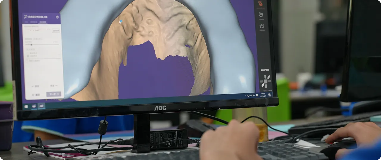 Close-up of a computer screen showing dental 3D modeling software with hands on keyboard and mouse.
