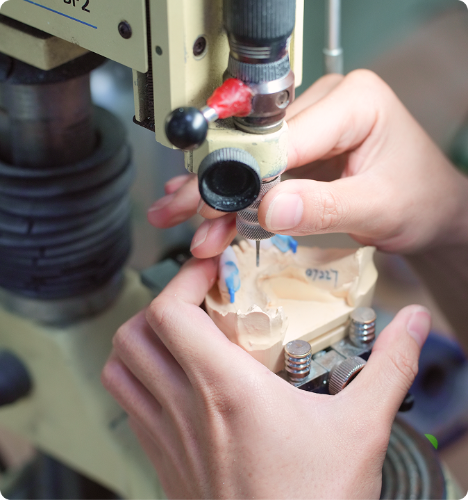 Hands using a tool on a dental mold for precise shaping or adjustment.