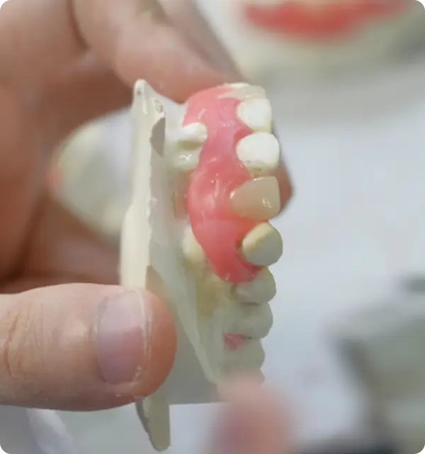 Hand holding a dental model showing teeth and pink gum imitation.