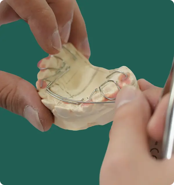 Hands adjusting a metal orthodontic retainer on a dental mold of upper teeth.