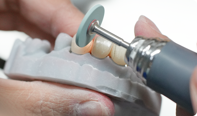 A dental technician uses a rotary tool to polish artificial teeth on a dental mold.