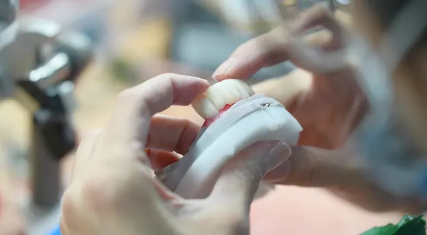 Close-up of hands holding a dental model with artificial teeth being adjusted.
