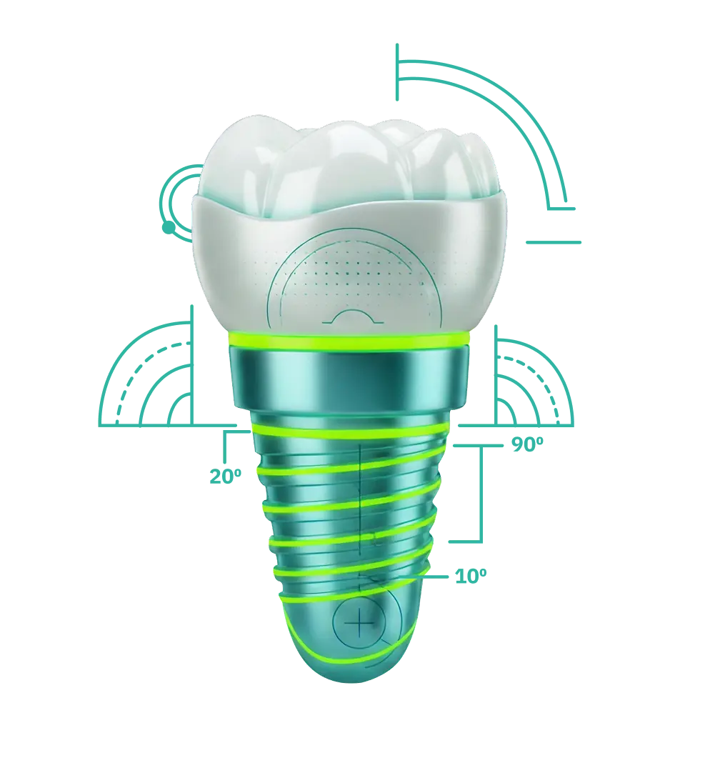 Digital render of a dental implant with a white tooth crown on top and metallic screw base with green highlights.