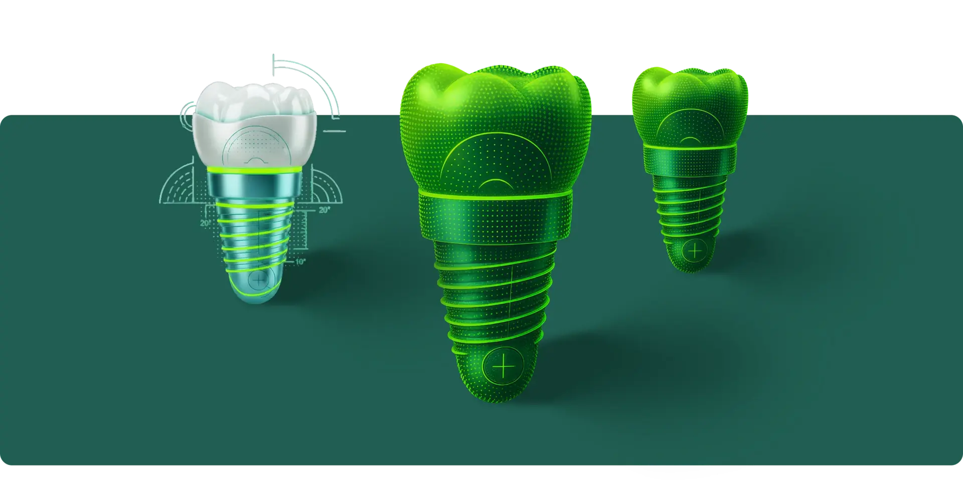 Implants image