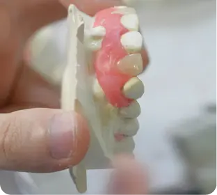 Hand holding a dental mold with a pink gum model and upper teeth.