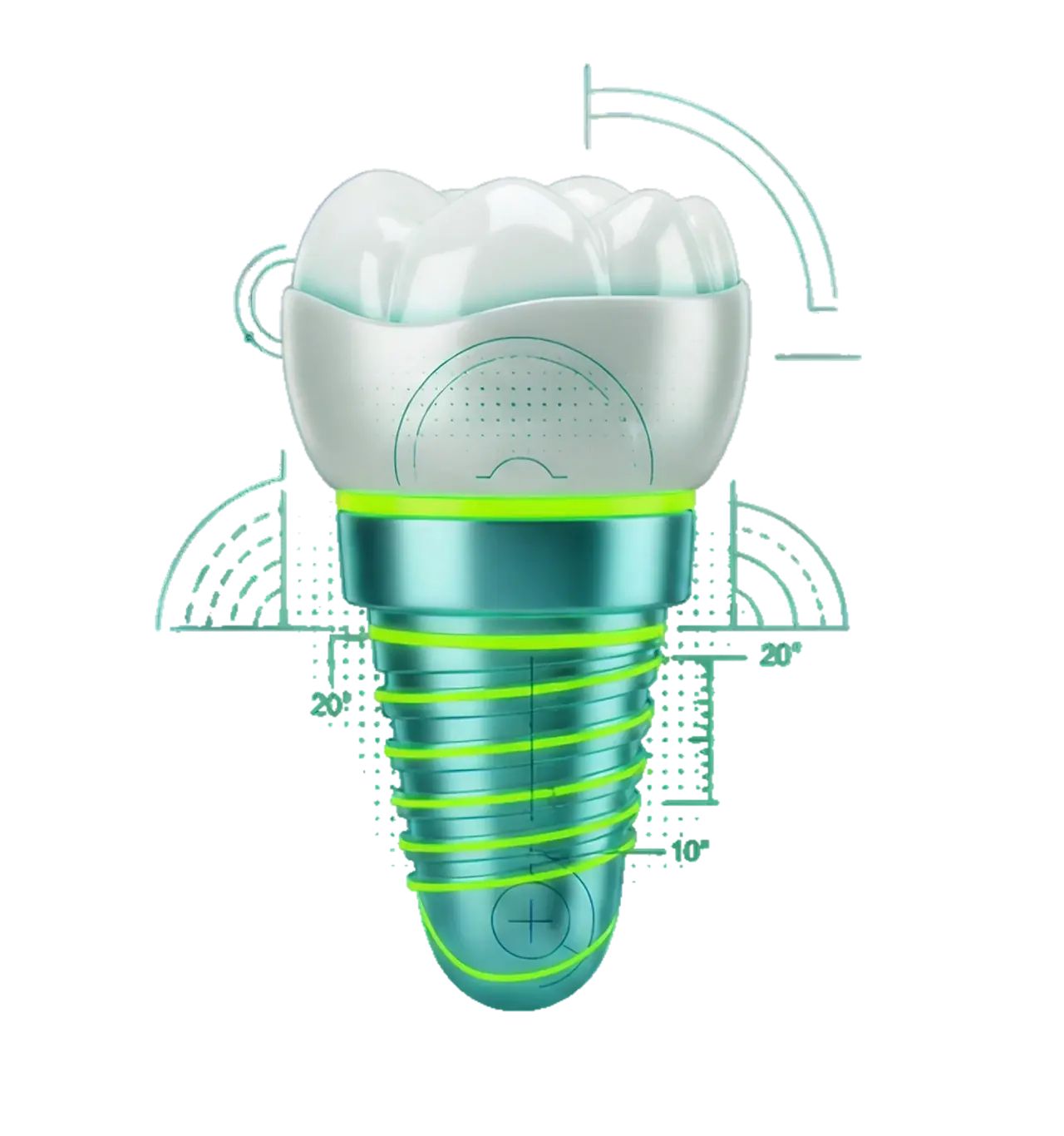 3D illustration of a dental implant crown with measurement angle diagrams.