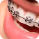 Close-up of lower teeth with dental braces on the lips and mouth.