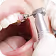 Dentist performing a dental procedure inside a patient's mouth using dental instruments.