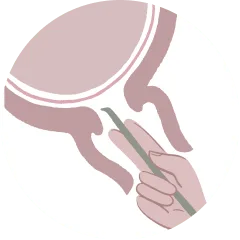 Breaking your
waters