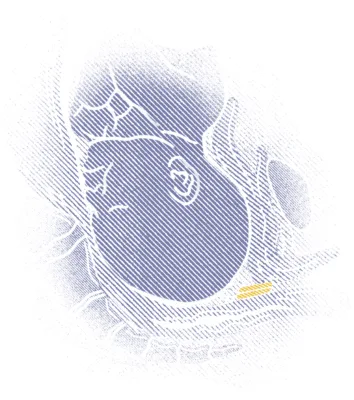 Illustrations for communication towards mothers