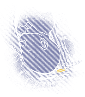 Illustrations for communication towards HCP