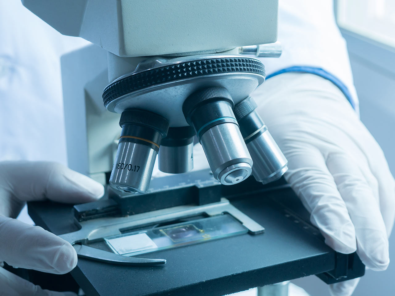 Mikroskopowe Badanie Żywej Kropli Krwi w HOLISTIC MED