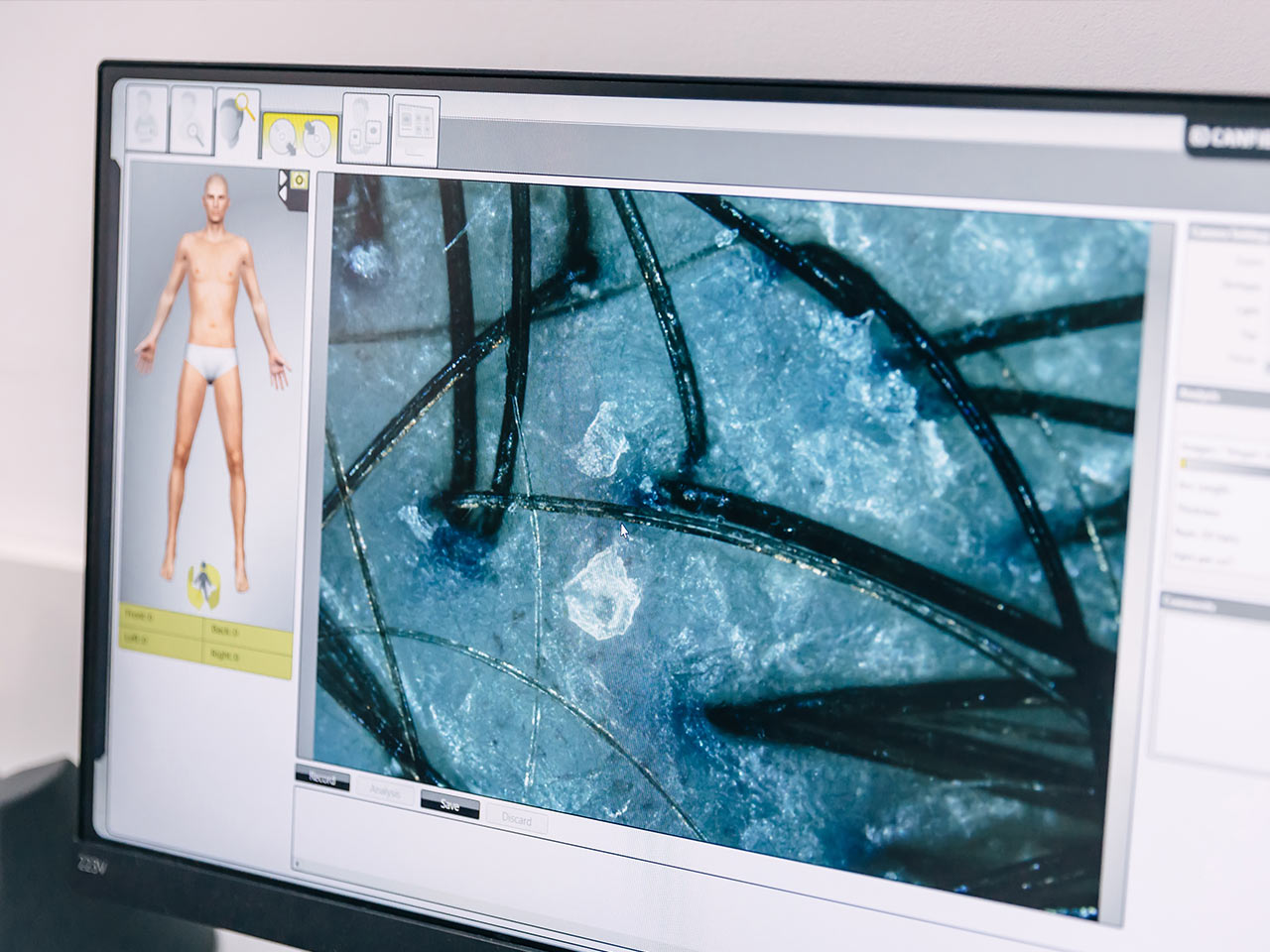 Diagnostyka mieszków włosowych w HOLISTIC MED