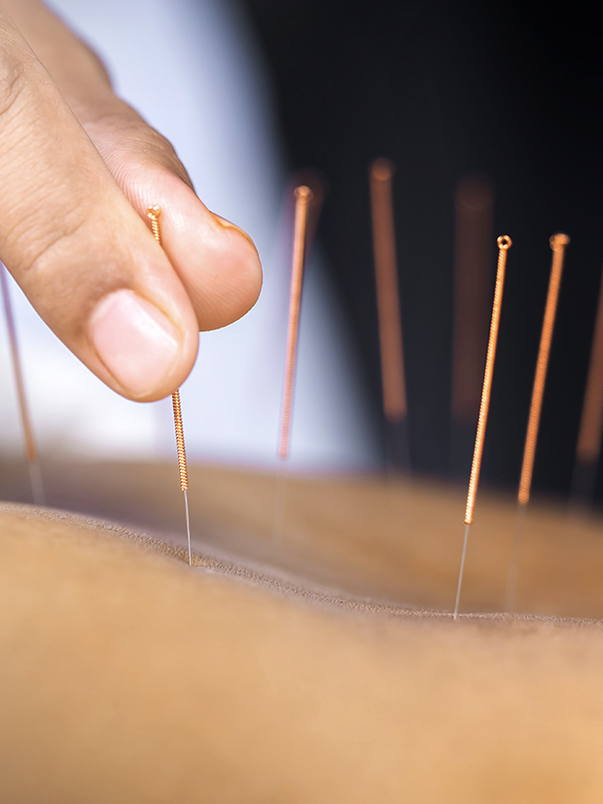 Akupunktura w HOLISTIC MED™