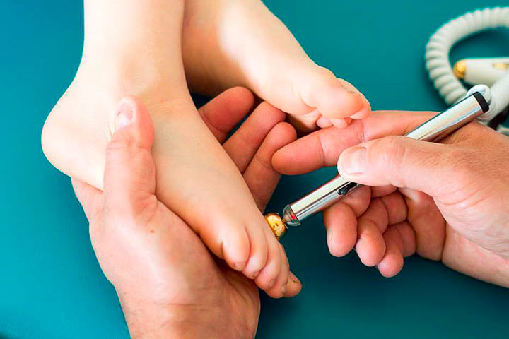 Elektropunktura w HOLISTIC MED™