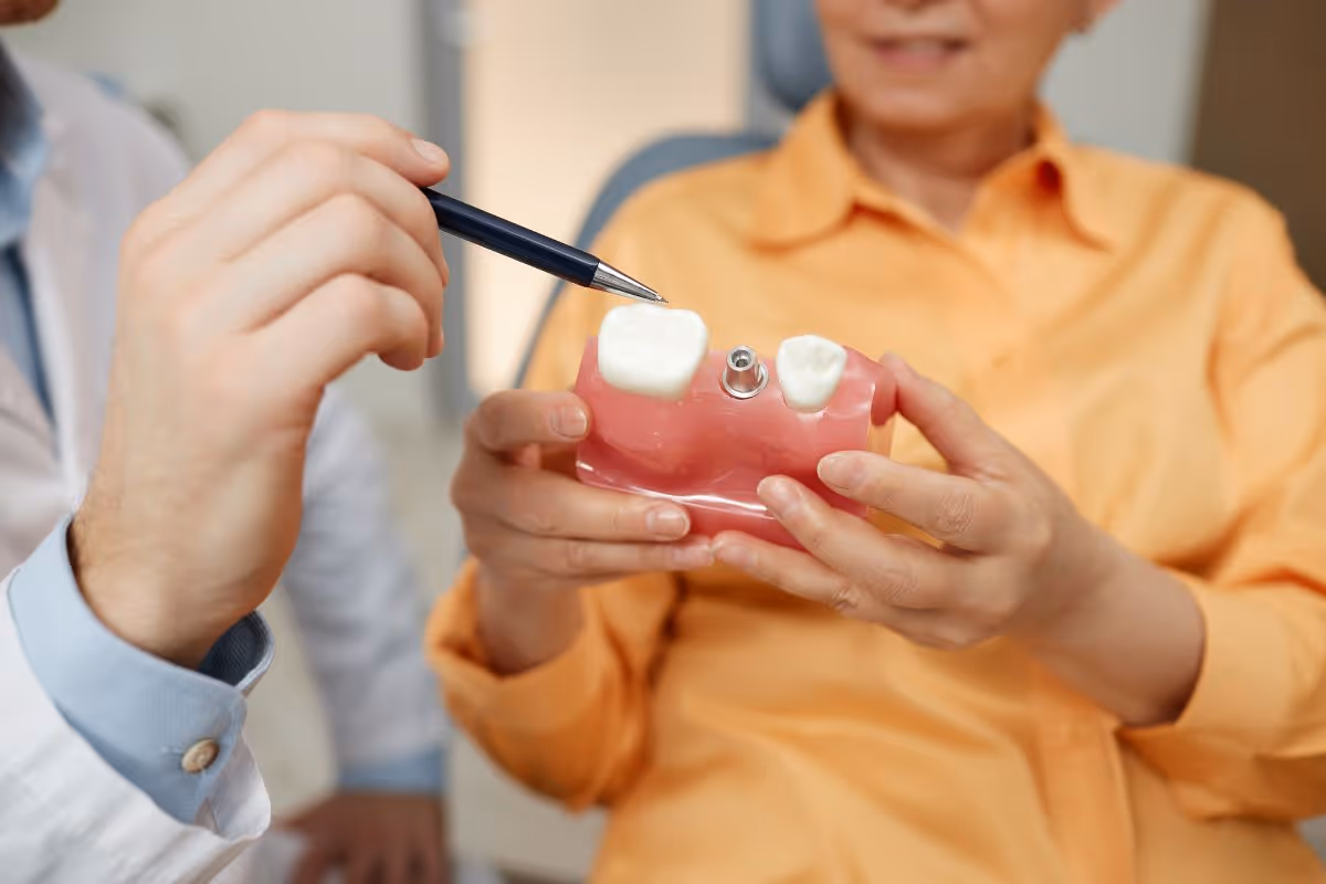 Everything You Need To Know about Dental Implants in Pasadena