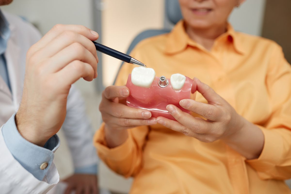 Everything You Need To Know about Dental Implants in Pasadena