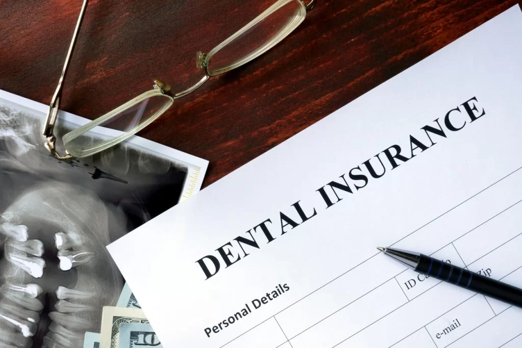 Does Insurance Cover Dental Implants?