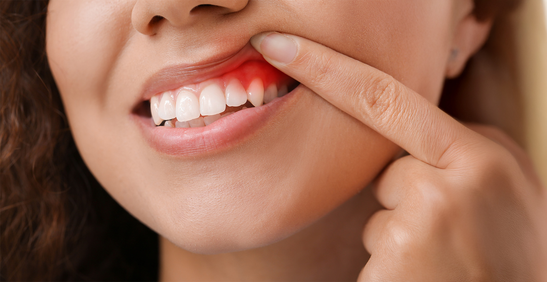 Periodontal treatment