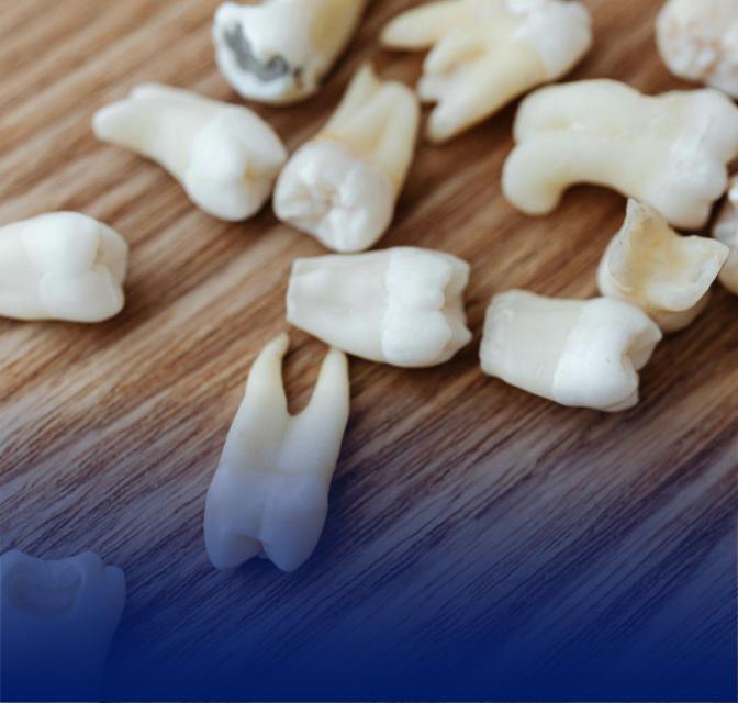 Is tooth extraction painful?