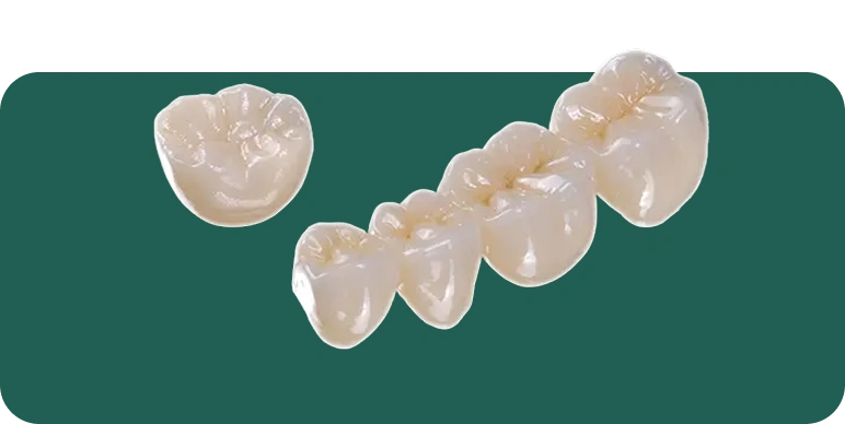 Zirconia dental crown restoration on a dental model.