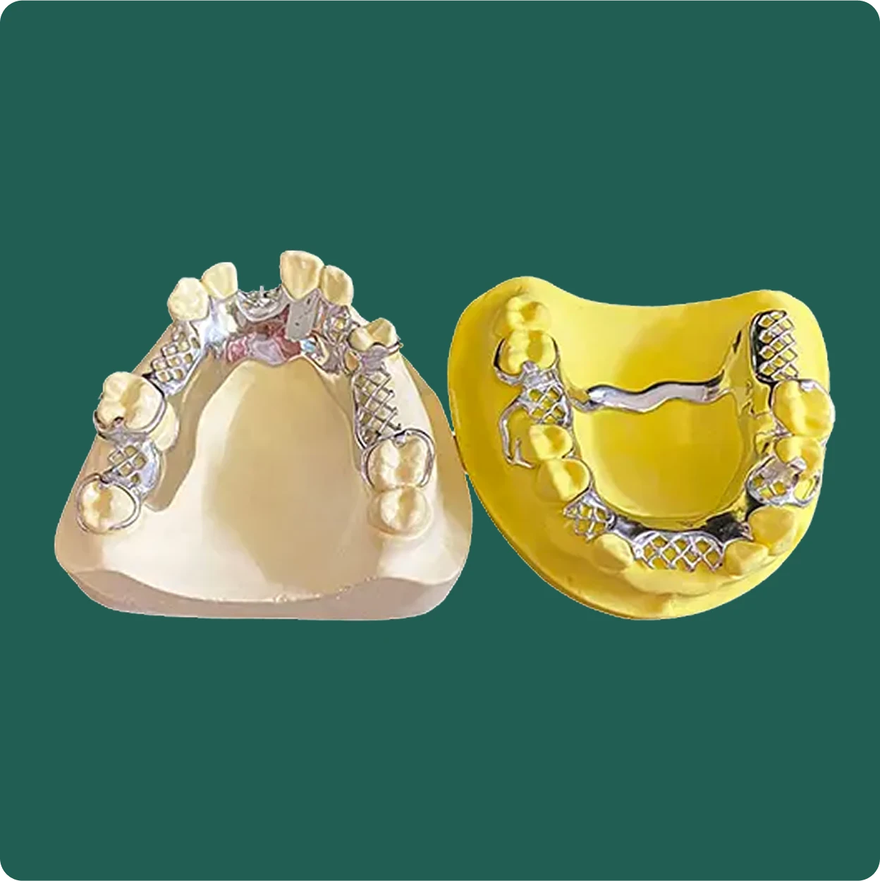 After photo of a finished removable partial denture restoration crafted by NovaDent Labs.