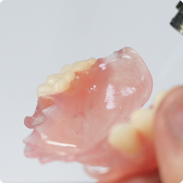 Thumbnail image representing a removable partial denture case from NovaDent Labs' case gallery.