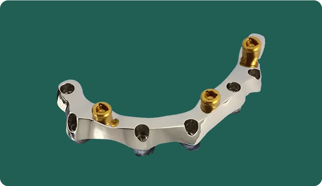 Close-up photo of an implant crown restoration crafted by NovaDent Labs dental laboratory.