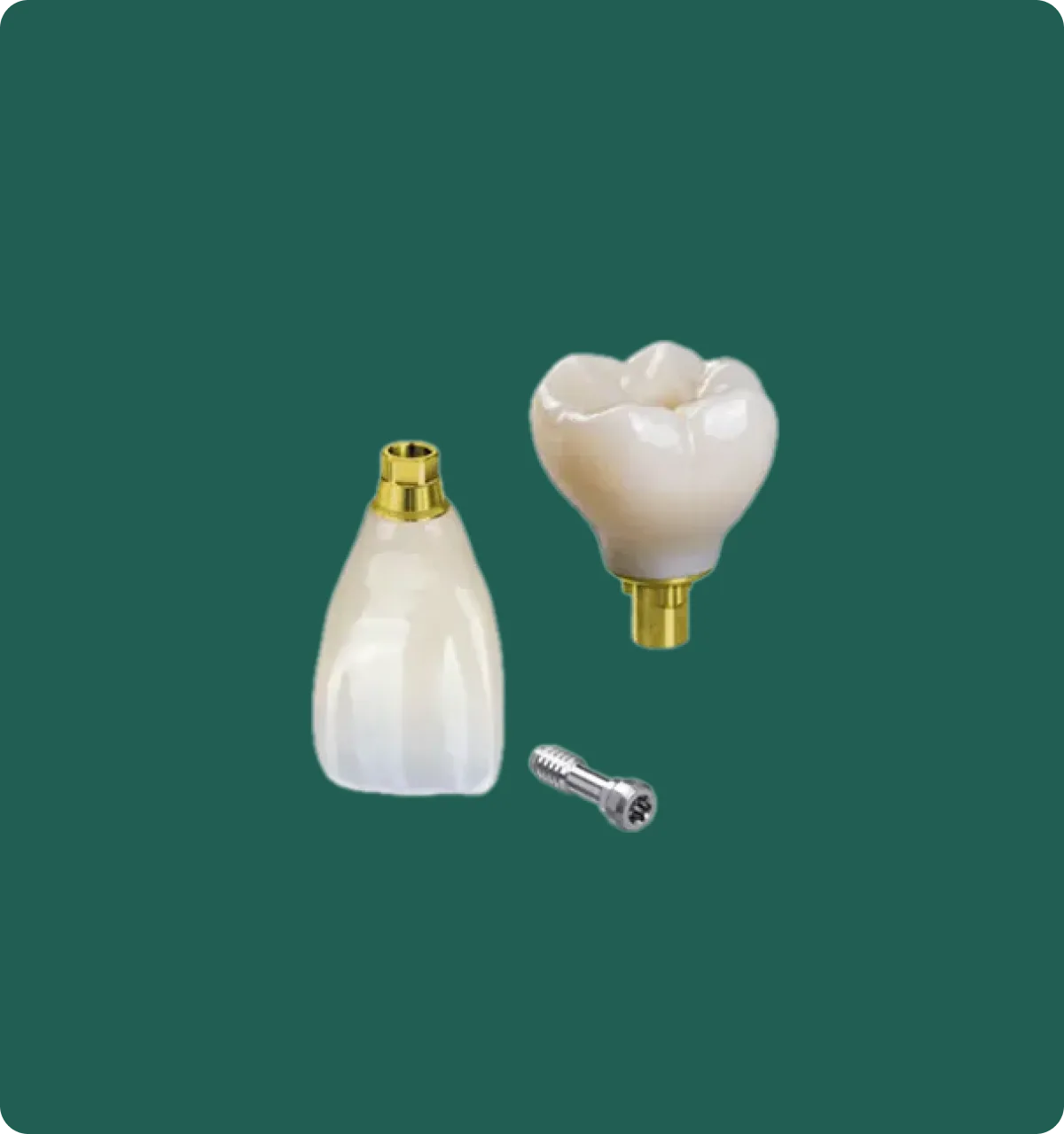Close-up of an implant crown and custom abutment assembly from NovaDent Labs' implant restoration bundle.