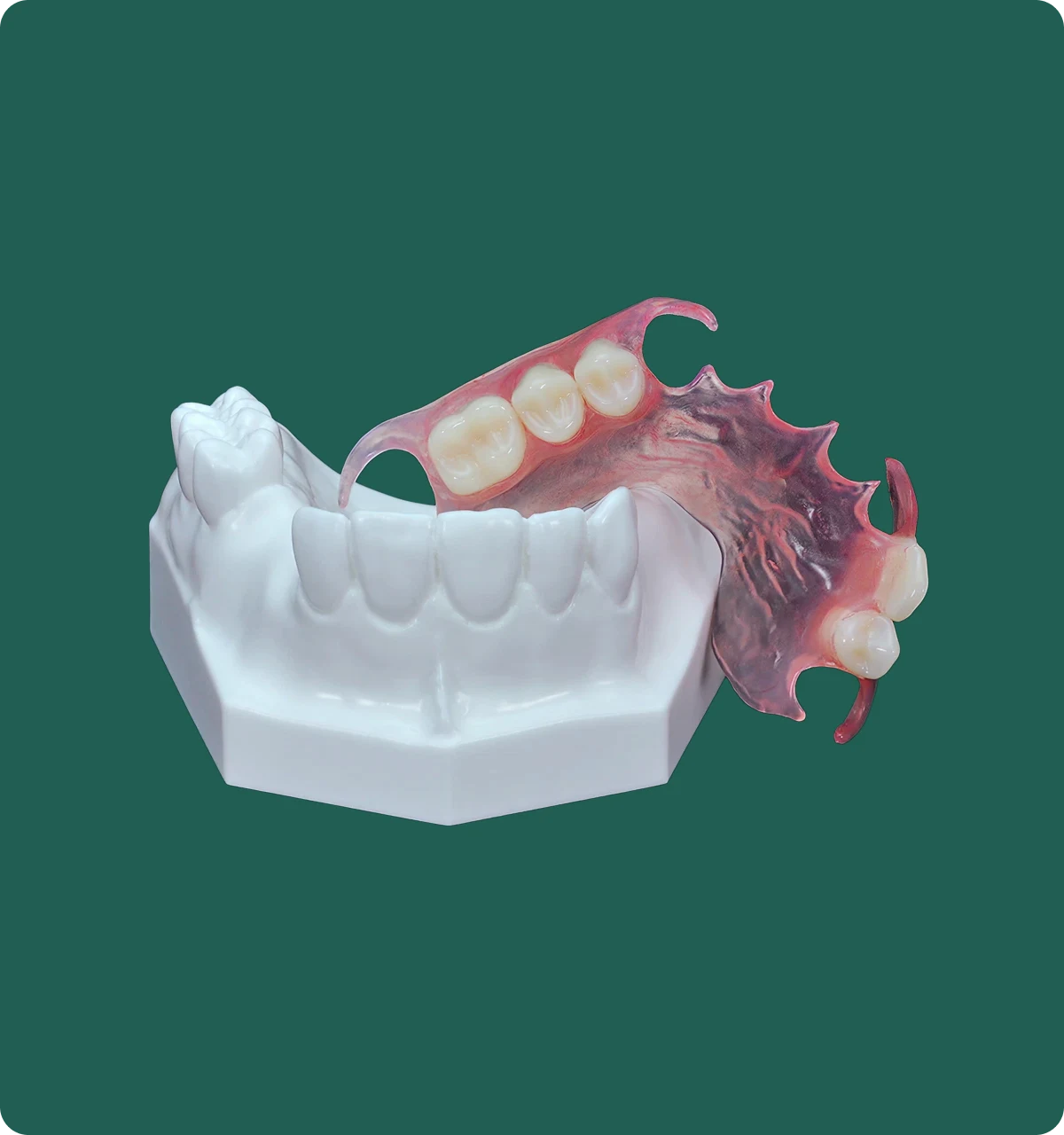 Close-up of a Valplast partial denture's flexible clasps gripping the remaining natural teeth.