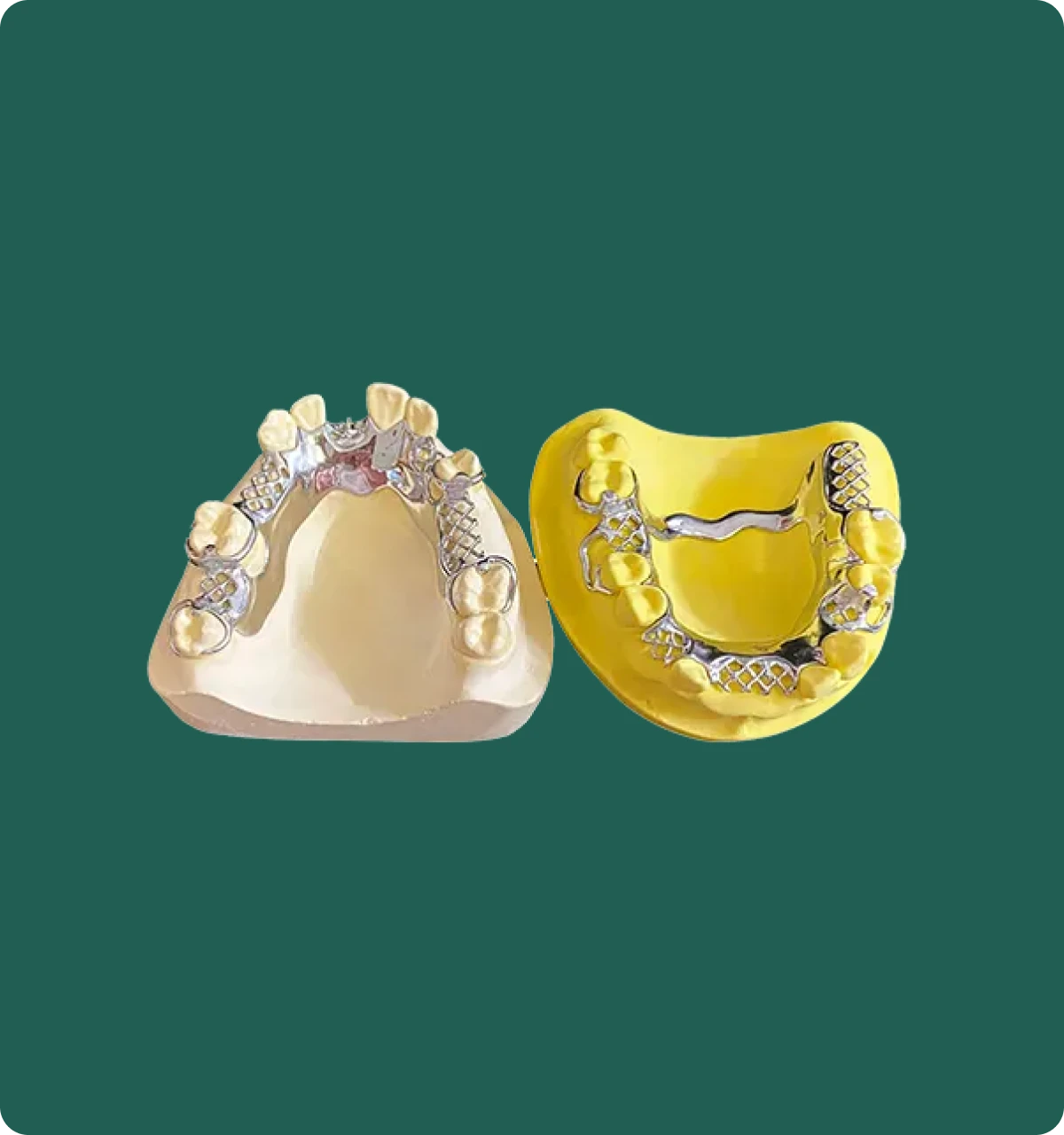 Close-up of a cobalt chrome framework's precision-cast clasps fitted on a dental model.