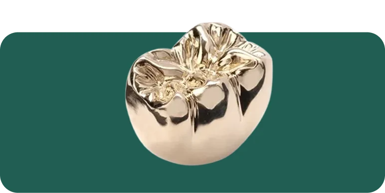 Cast metal dental restoration on a model, showing a dental alloy crown prepared for cementation.