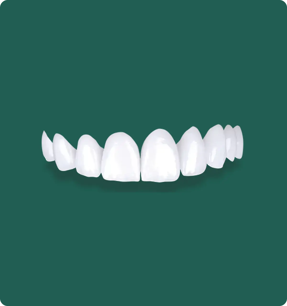 Close-up of a PFZ restoration, its natural translucency concealing the underlying zirconia core.
