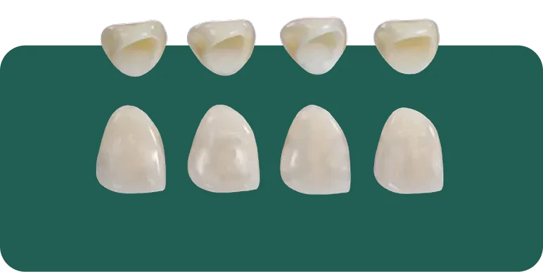 Close-up of a finished IPS e.max crown showing its polished surface finish and anatomical detail.