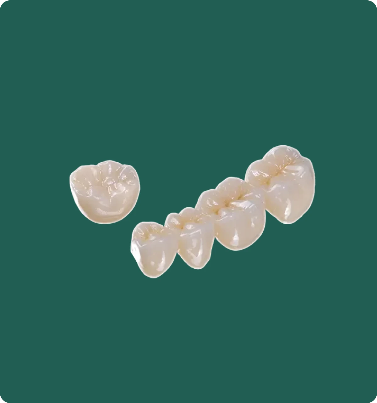 Zirconia dental crown on a model, showing its bright white shade and chip-resistant surface strength.
