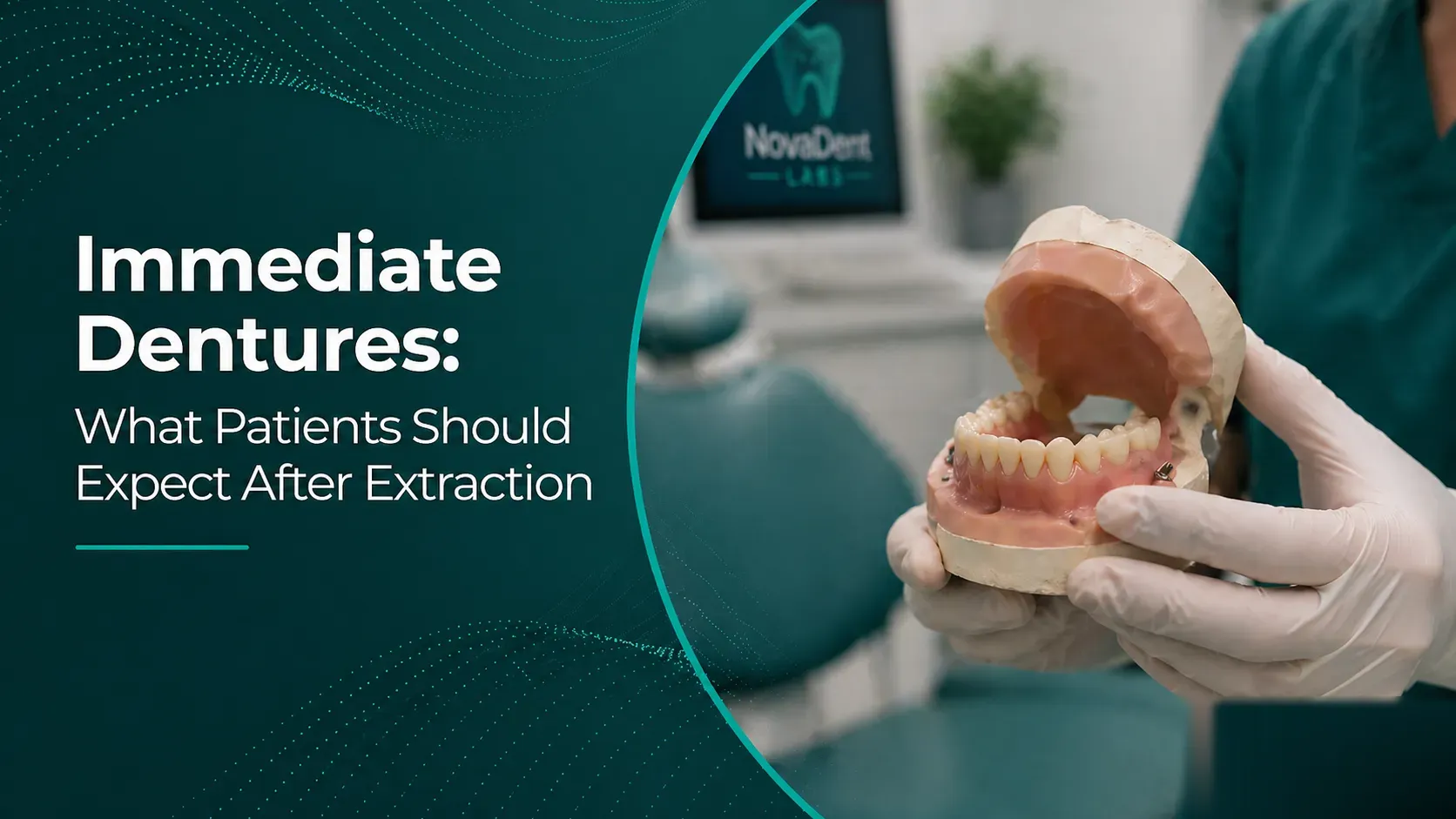 Immediate denture positioned over the gums right after tooth extraction
