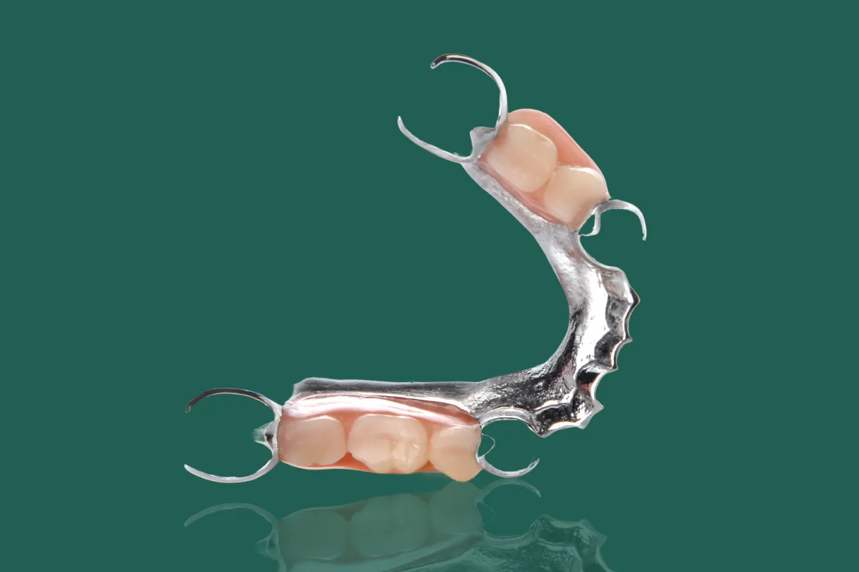 Partial denture replacing missing front teeth for a natural-looking smile