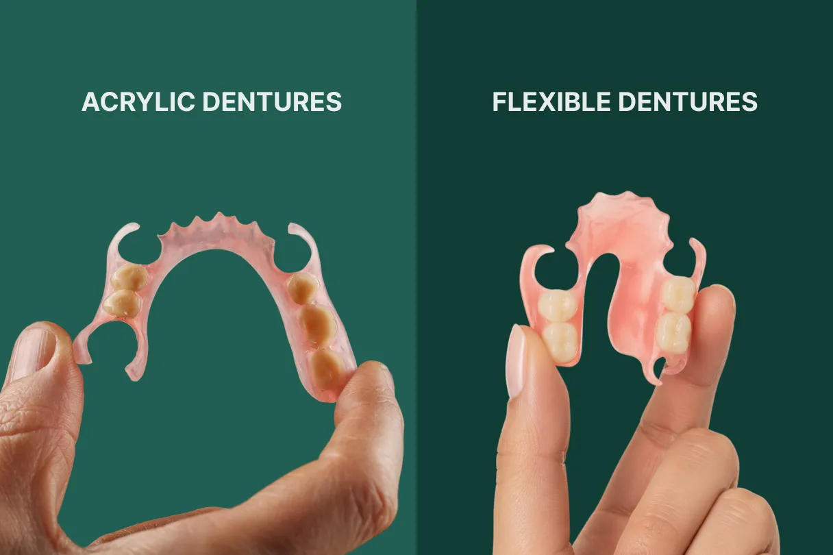 Rigid acrylic denture and a flexible denture shown together to compare material and comfort