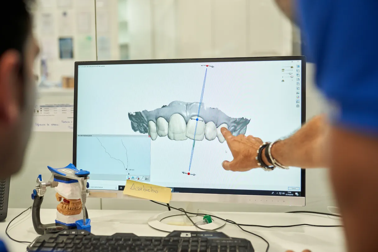 CAD/CAM software screen displaying a digitally designed dental crown for milling