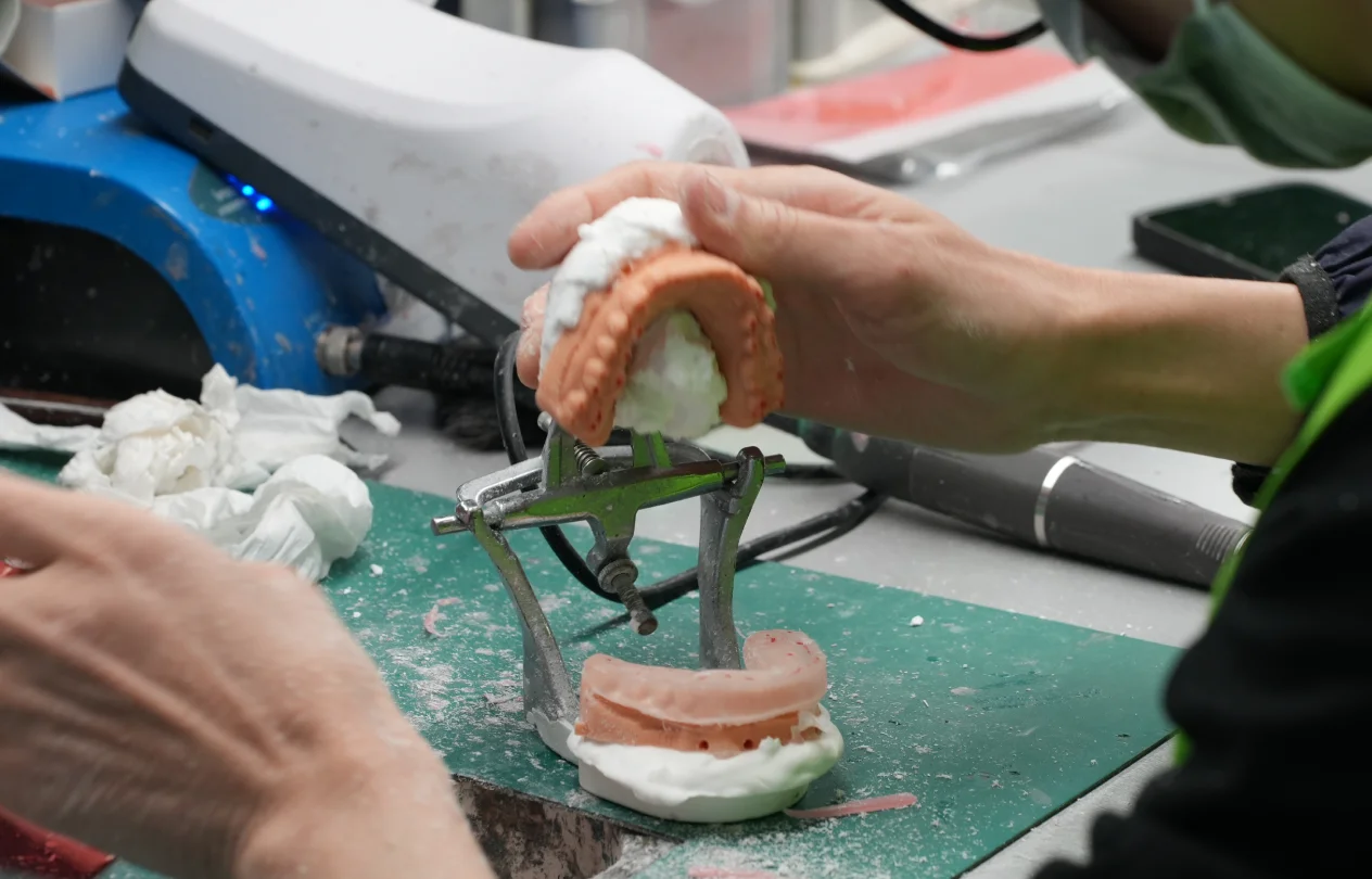 Dental implant components including the titanium fixture, abutment, and crown laid out separately