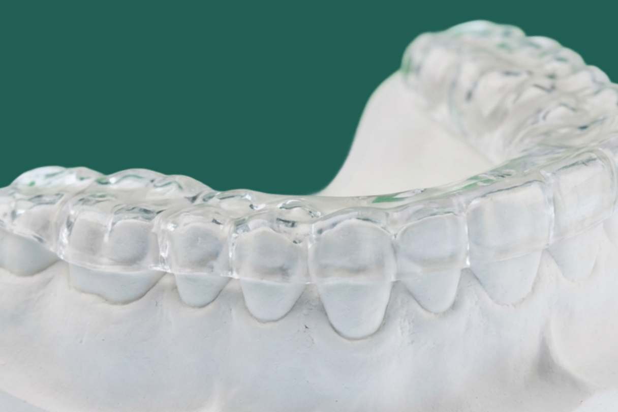Illustration of a person clenching and grinding their teeth during sleep