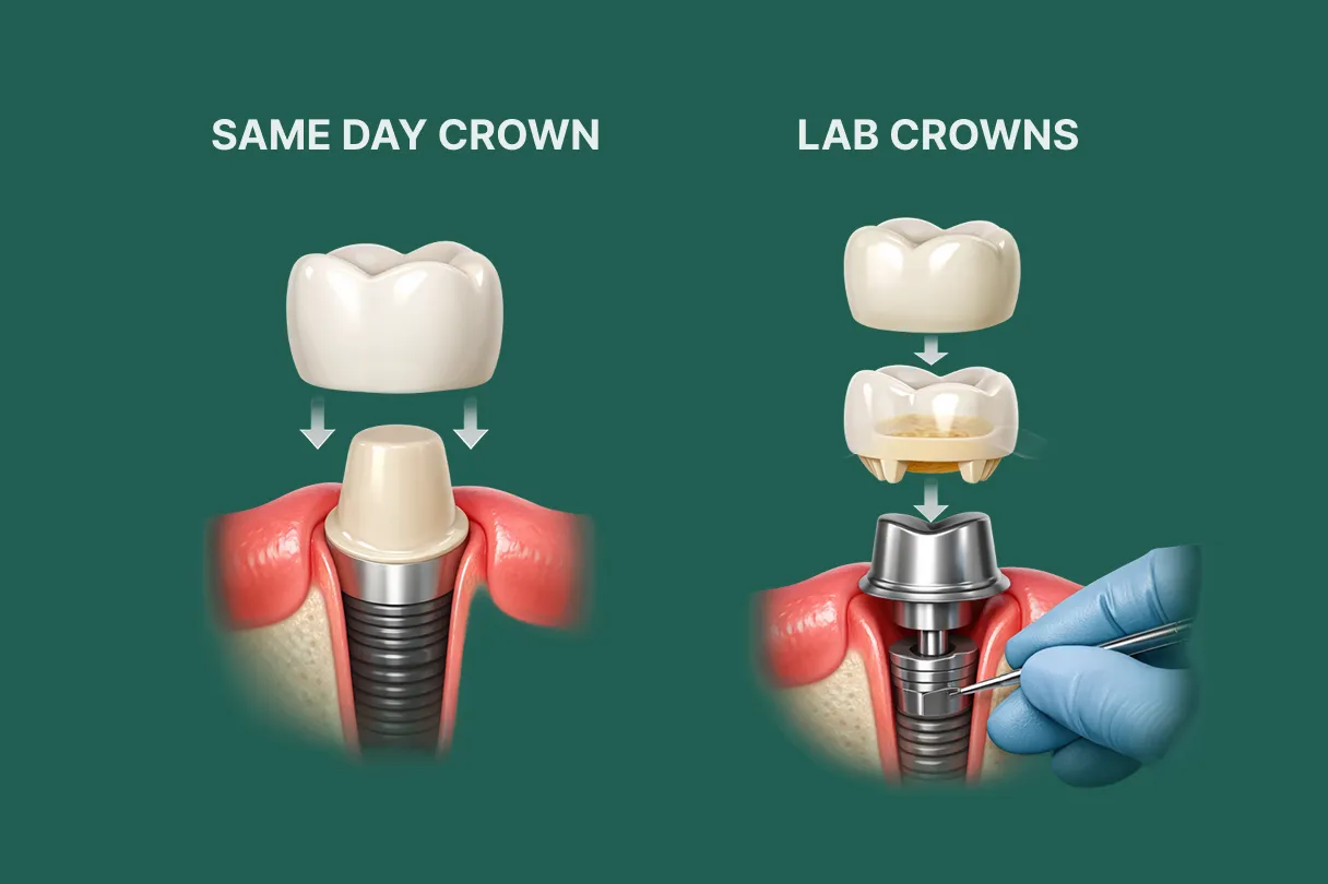 Chart comparing the same-day milled crown process with the traditional lab-made crown workflow