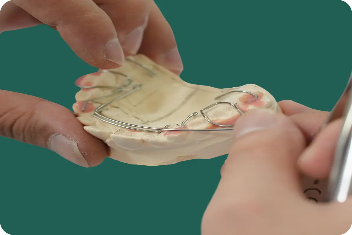 All-on-4 implant framework supporting a full arch of replacement teeth