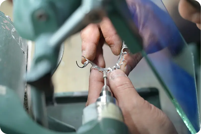 All-on-4 dental implants placed at an angle to support a full arch restoration