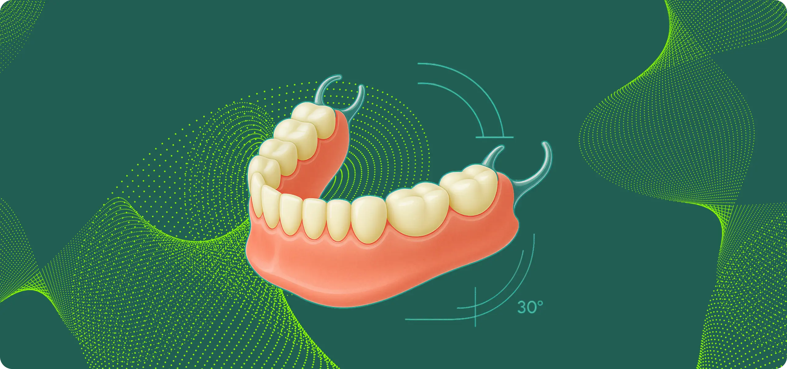 Removable denture and a fixed implant-supported bridge displayed together for comparison