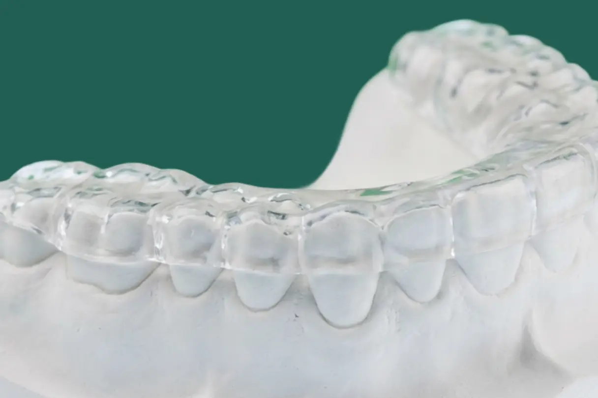 Illustration of a person clenching and grinding their teeth during sleep