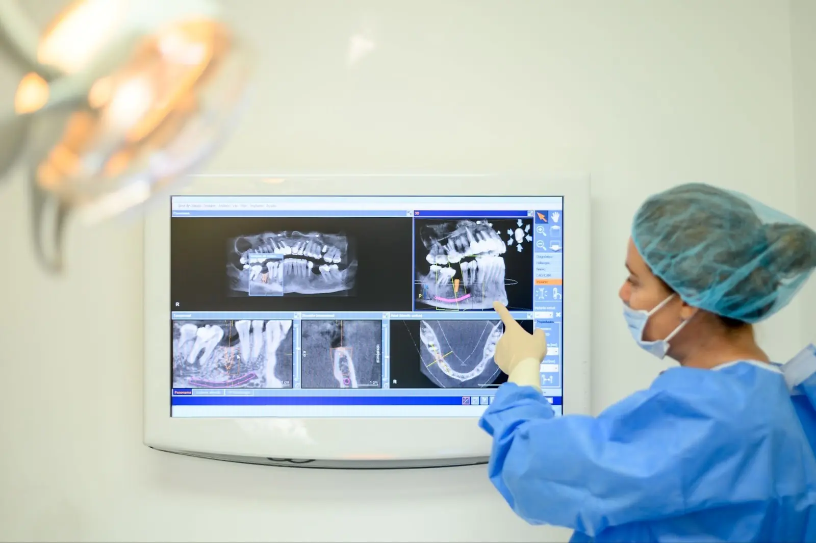 Digital cross-section comparing planned and actual implant sleeve positions in a surgical guide