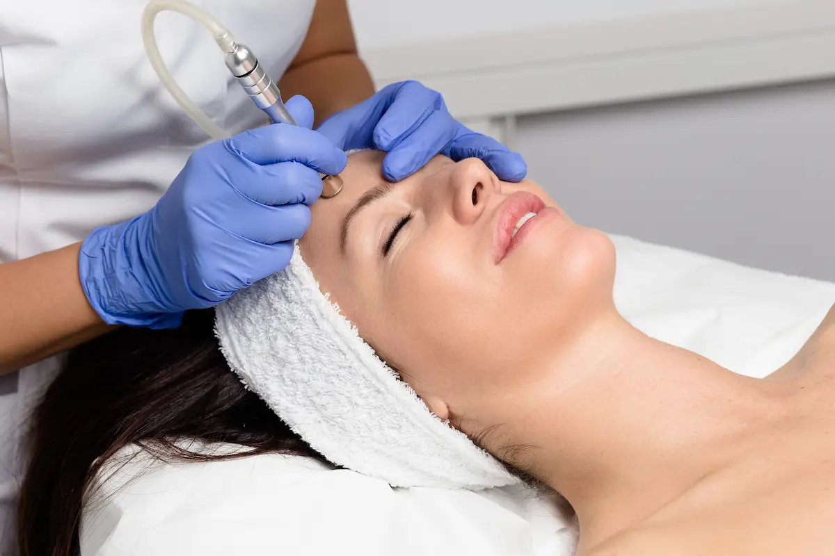 RF Microneedling